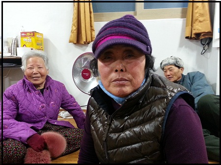 ▲  고구옥(67) 갑상선암 발병 후 폐암 진단. 증상-심장이 좋지 않음. 가족력(X), 술‧담배(X)