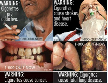 미국의 흡연경고그림.