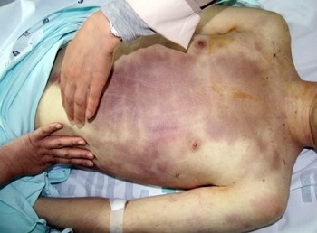 이미지 출처 = 군인권센터