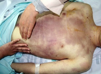 이미지 출처 = 군인권센터