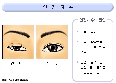 이미지출처='아이엠피터' 블로그