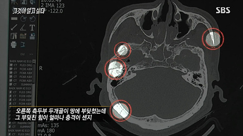 <이미지출처=SBS ‘그것이 알고 싶다-살수차 9호의 미스터리 백남기 농민 사망사건’편 방송캡처>
