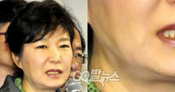 2014년 4월16일 오후 5시15분 중앙재해대책본부를 방문했을 당시 박근혜 대통령의 얼굴이다. 전문의들은 눈 주변이 워낙 잘 붓는 부위이기는 하지만 오후가 되면 부기가 빠지는게 보통인데 평소 대통령의 얼굴과 비교해 두드러져 보인다고 밝혔다. ⓒ go발뉴스